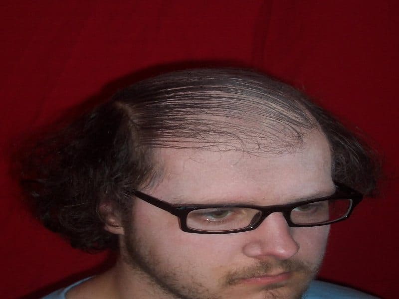 comb_over